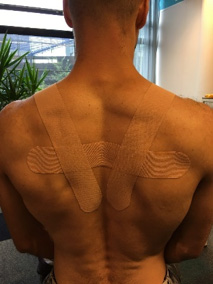 how to tape posture-curve-back-with-tape-speech therapy