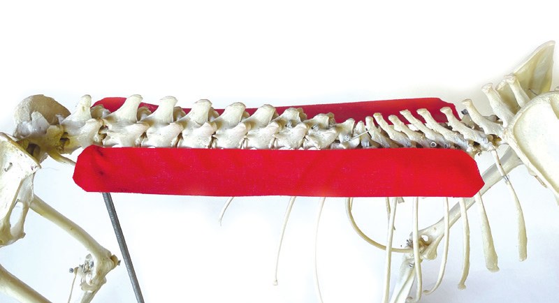 Tape position over the erector spinae muscle, shown on a skeleton