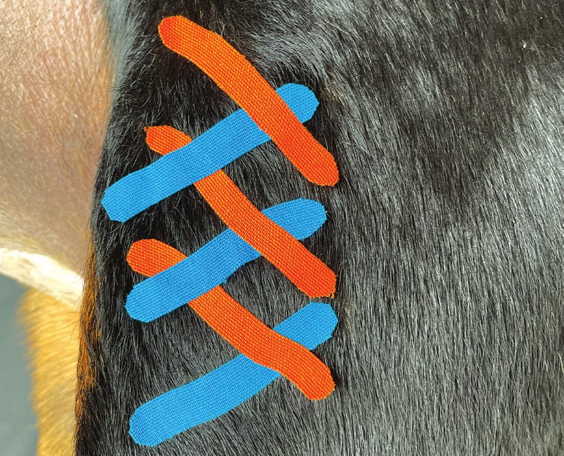 Scar tissue taping guide